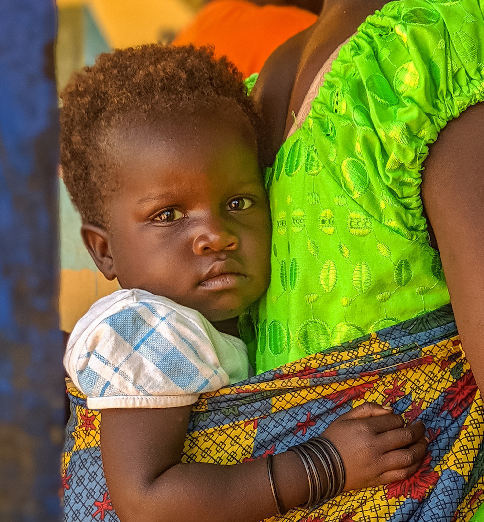 A South Sudanese child in the nutrition center.