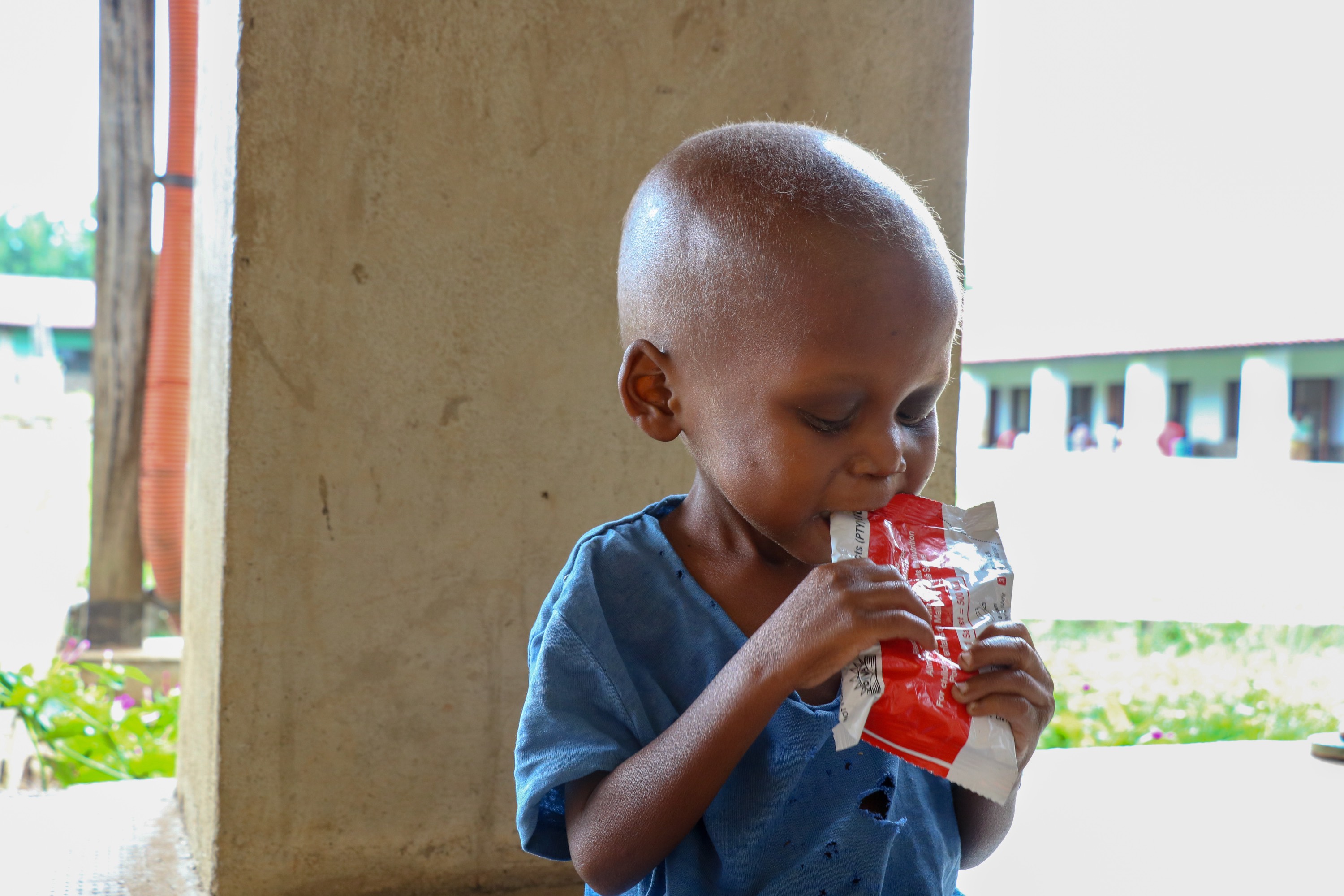 World Vision is supporting health centers and hospitals in Kasai Central to treat malnutrition