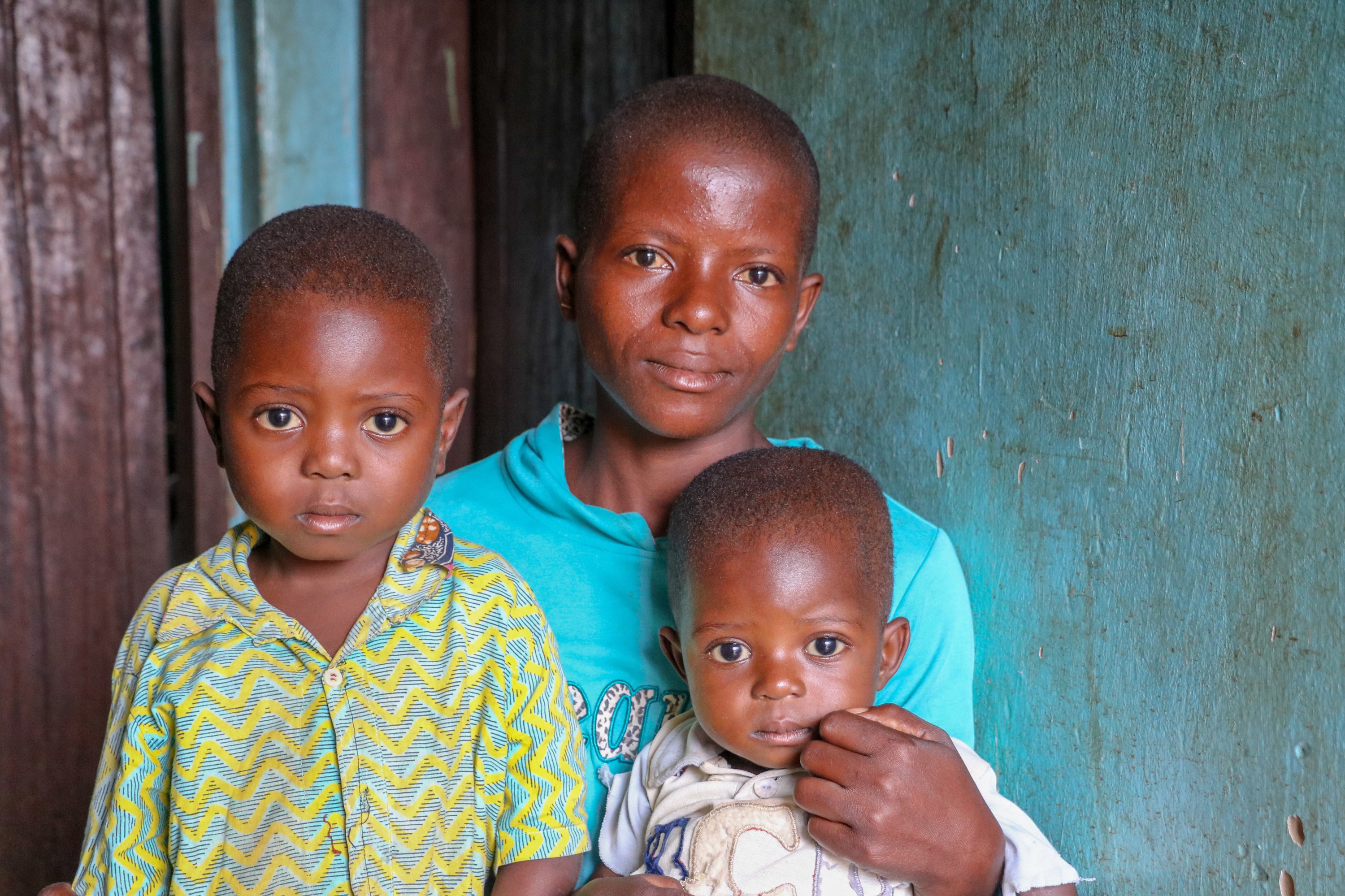Mishu is being treated for severe acute malnutrition in Dibaya