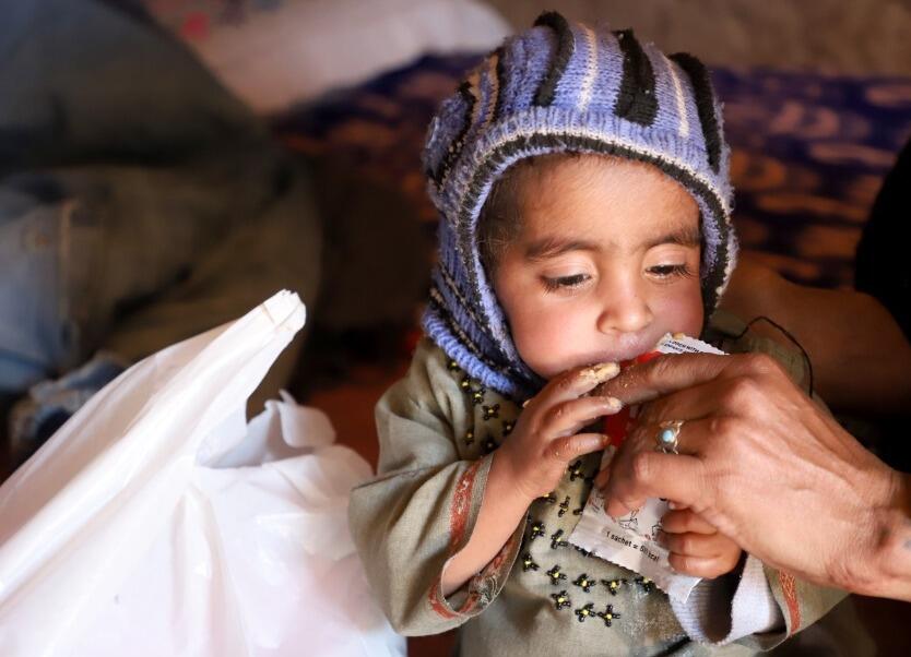 malnourished child in Afghanistan receives support