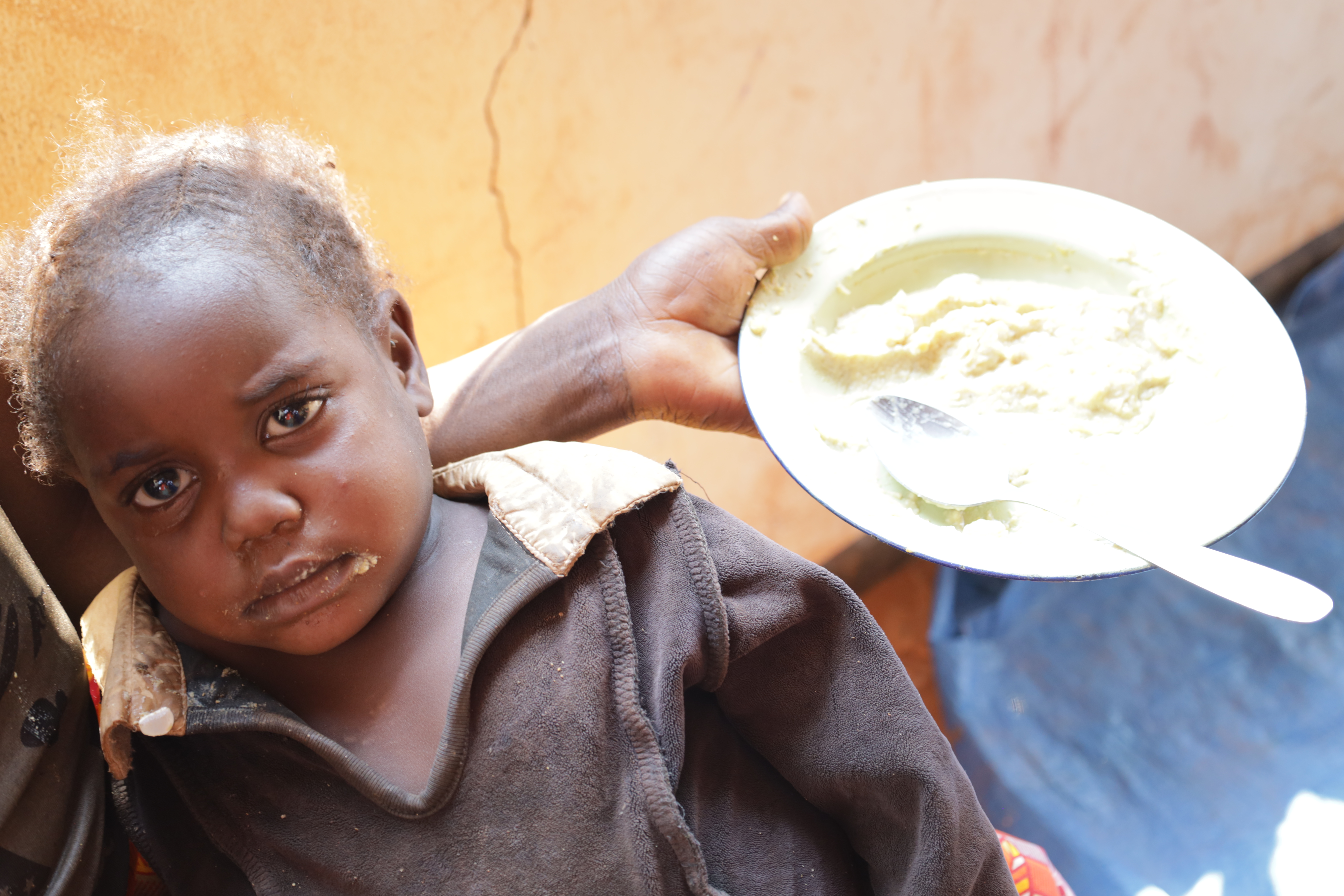 Child recovering from malnutrition