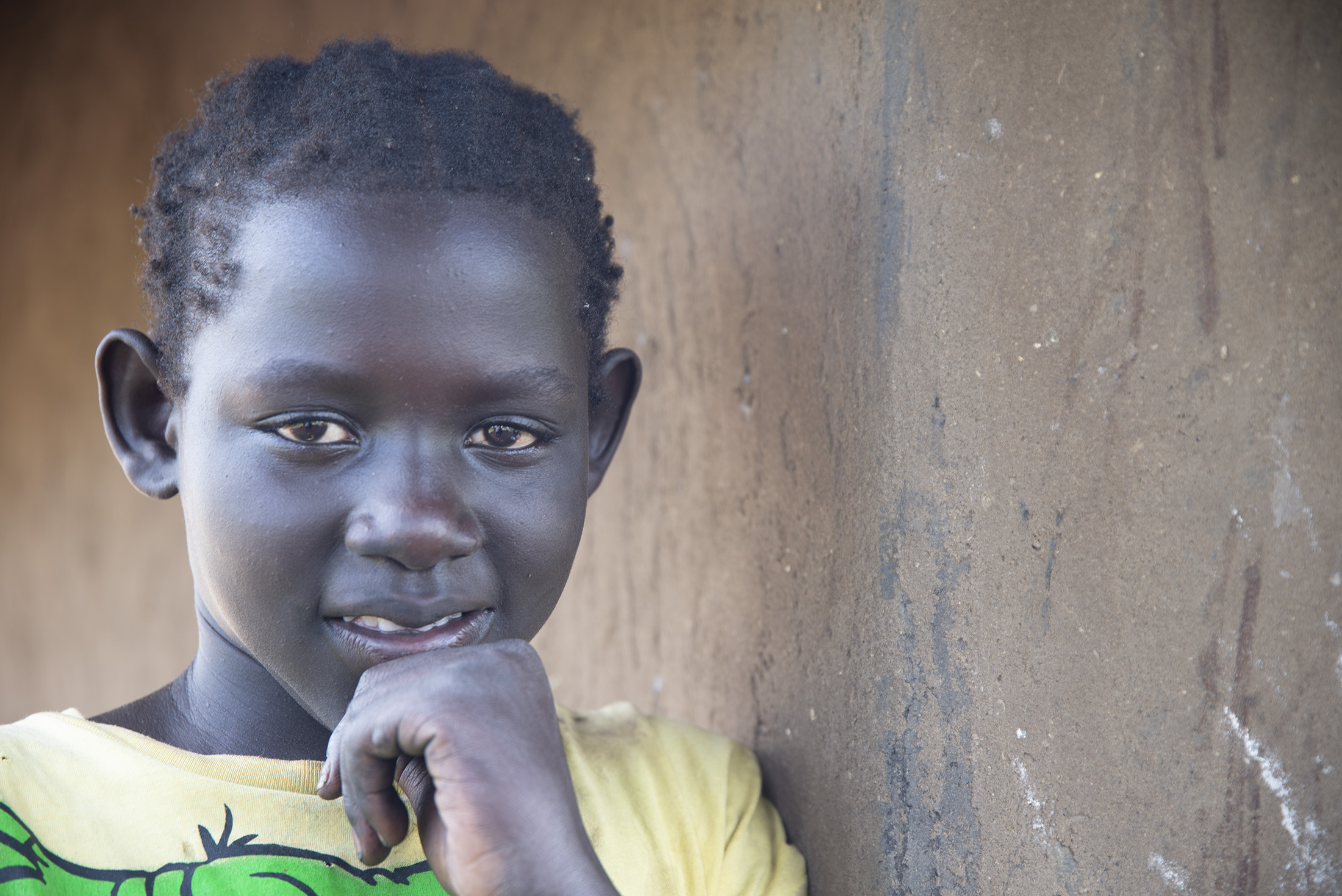 World Vision improving resilience and livelihood of refugee families in Adjumani district.