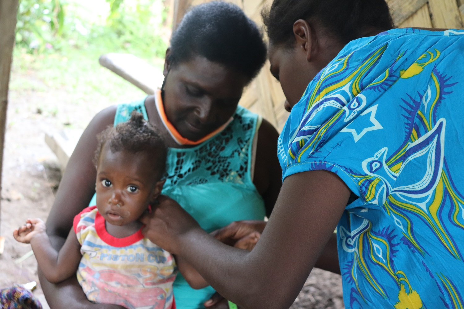 Child with severe malnourishment improves through Nutrition project  (3)