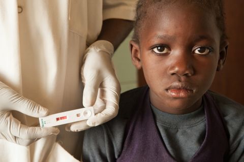HIV