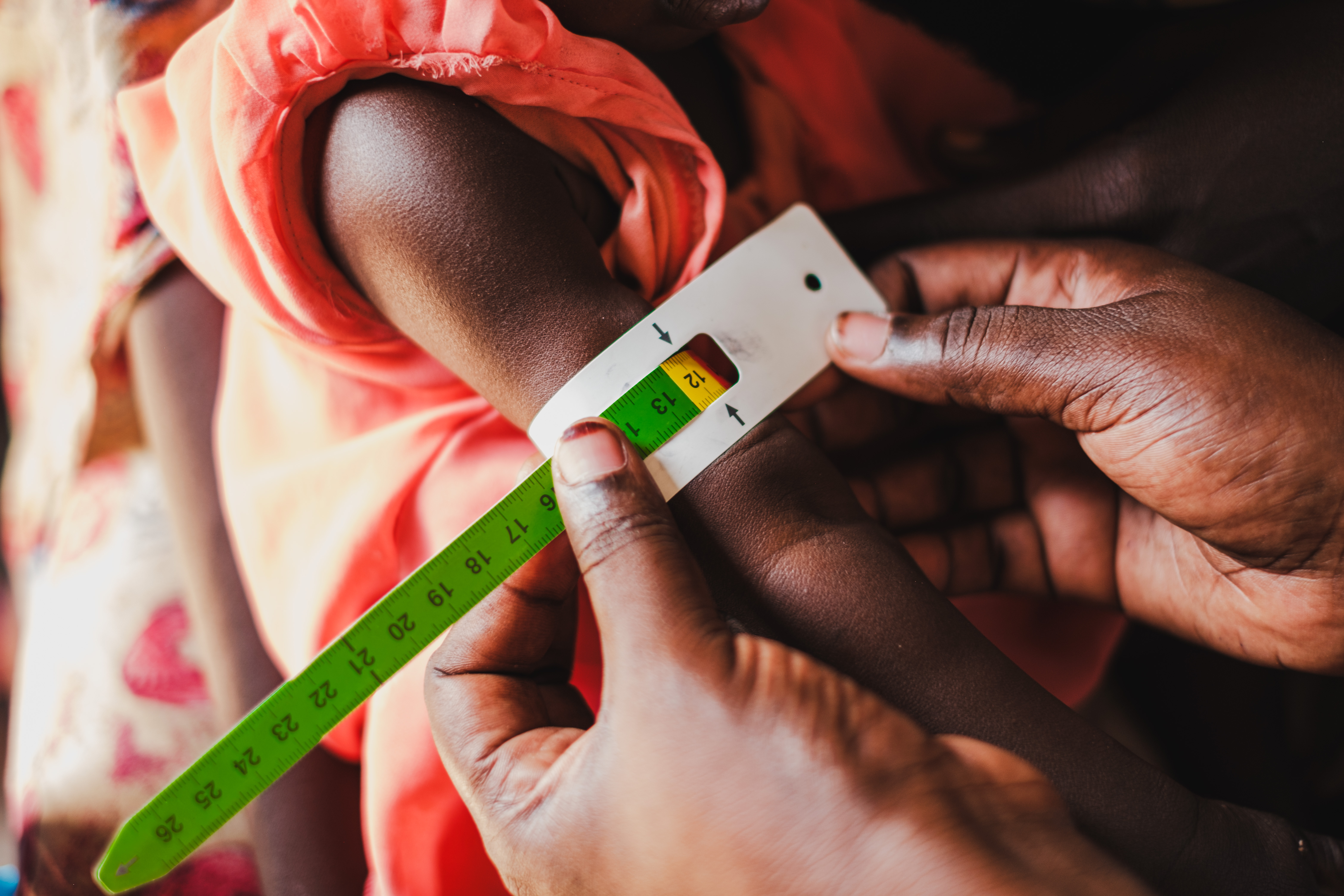 World Vision Health Center, Renk, South Sudan/2024.
