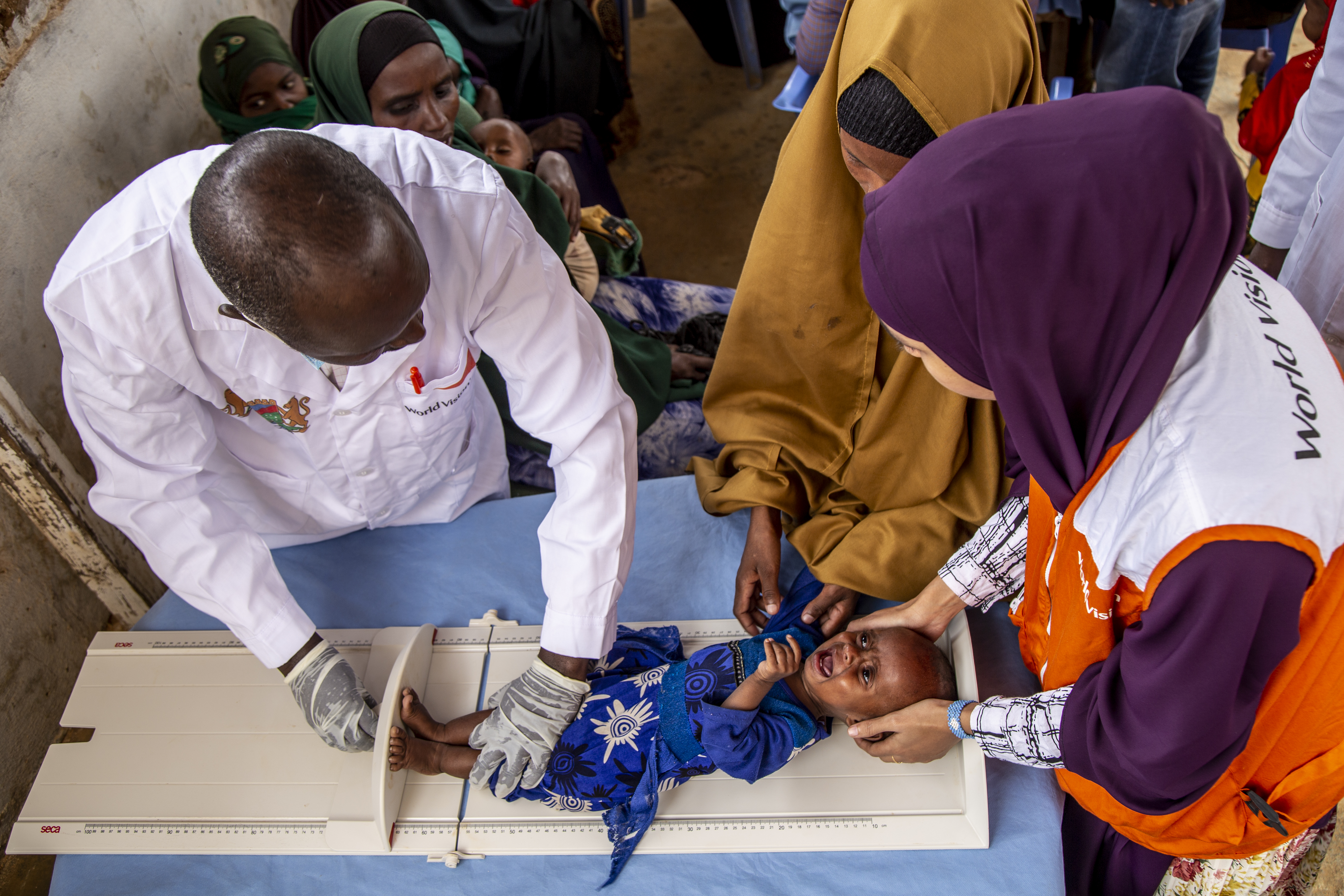 7-months-old Hamdi in Baidoa, is an example of how a perfect storm of a climate-fueled drought and high food prices is taking a toll on children as they increasingly experience hunger and become severely malnourished. 