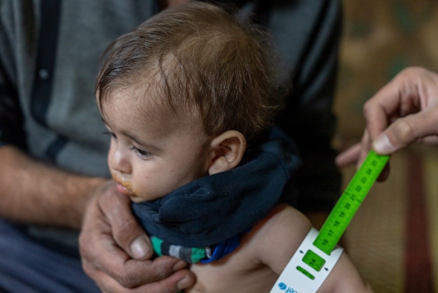 The malnutrition measurement (MUAC) for Abu Ali's youngest child. World Vision Syria Response - Zaher Jaber