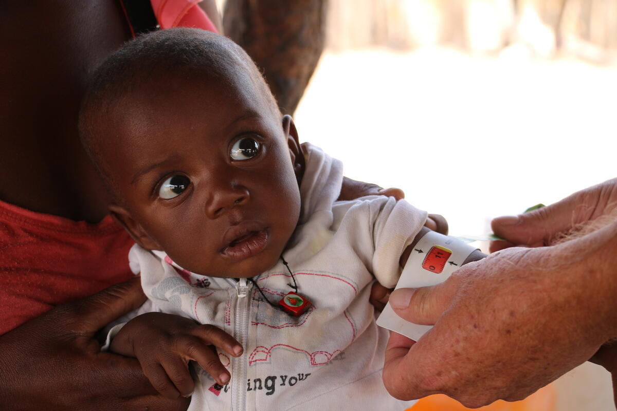 Young malnourished child in Angola