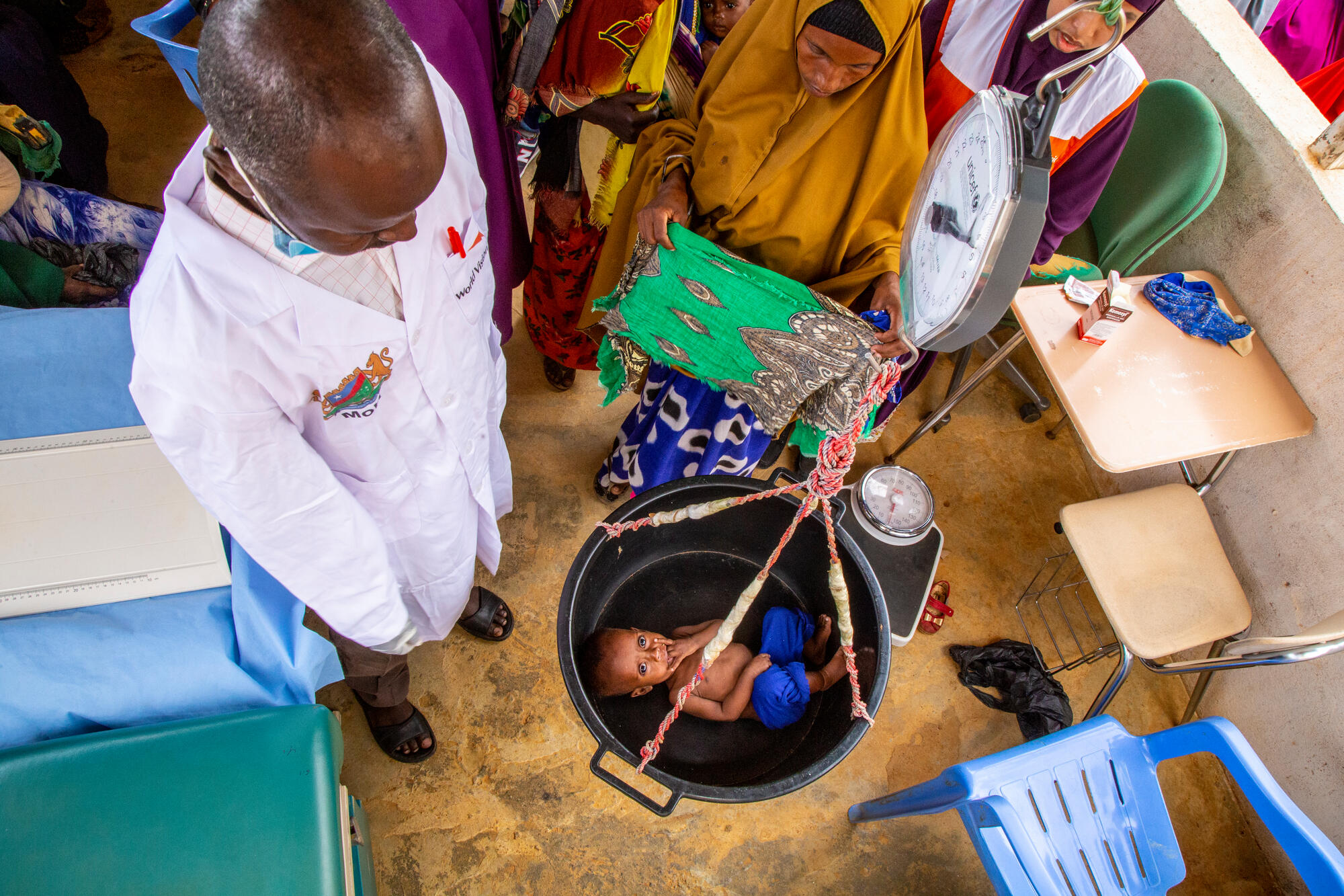 A severely malnourished Hamdi in July 2022
