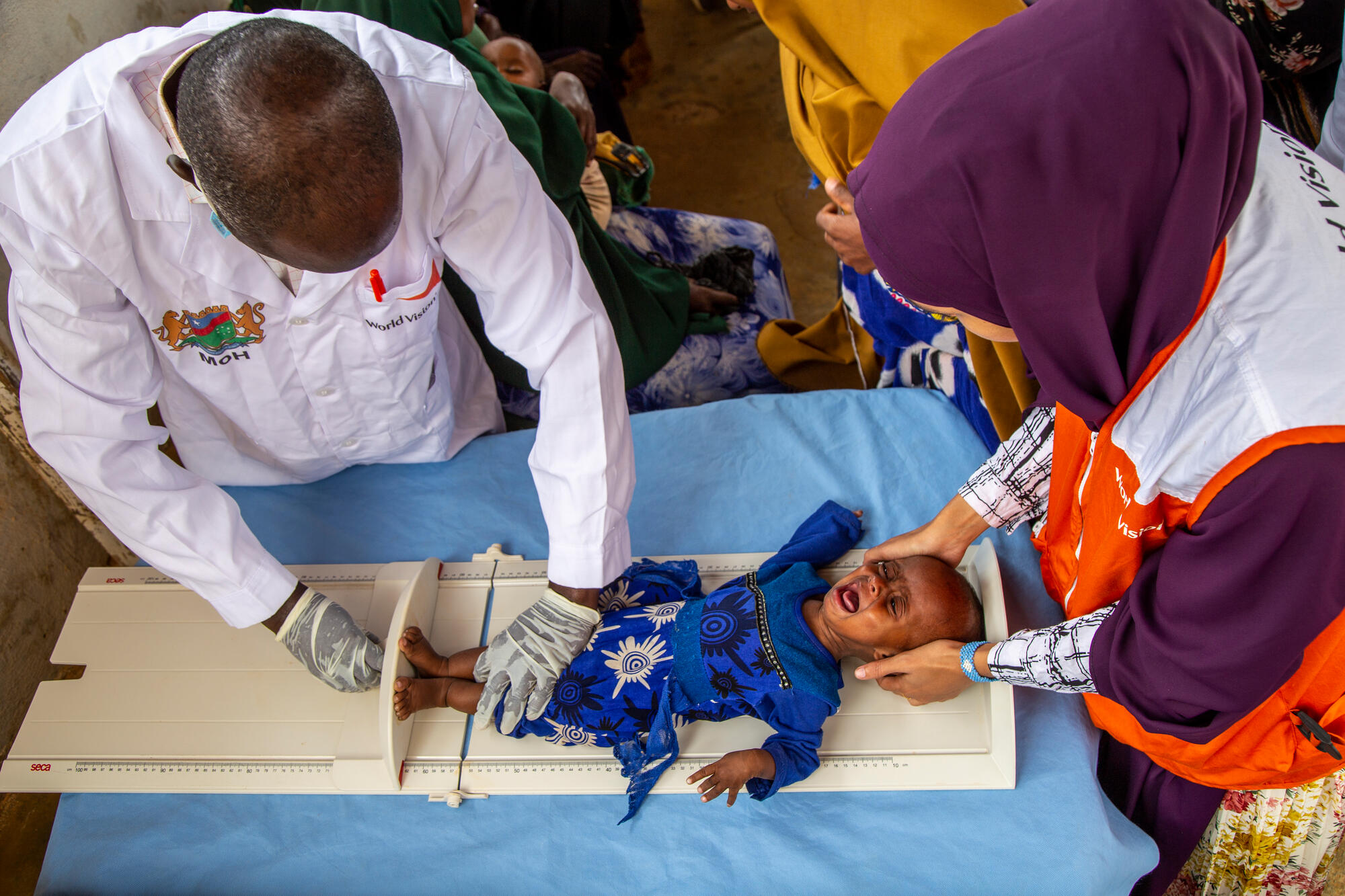 Hamdi is screened at a World Vision run nutrition centre in Baidoa in July 2022 