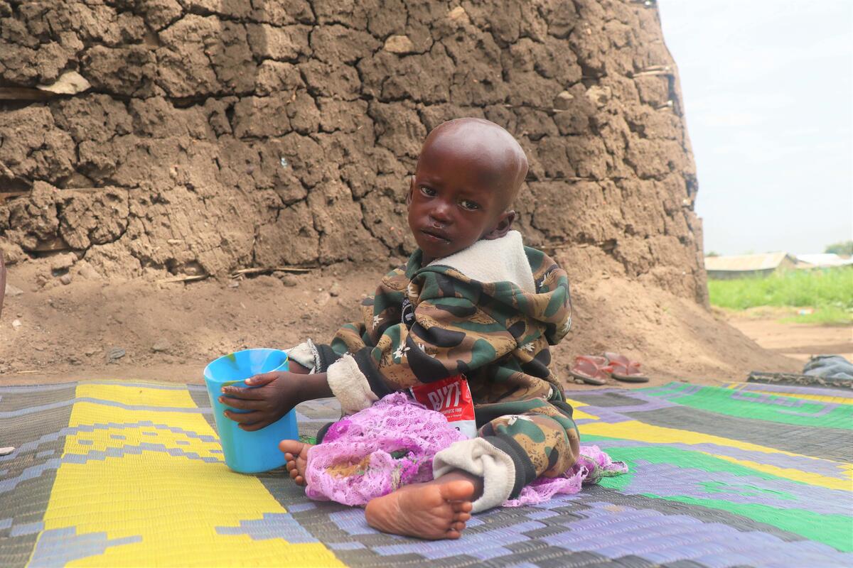 Ocan has been treated for malnutrition for a year in South Sudan 