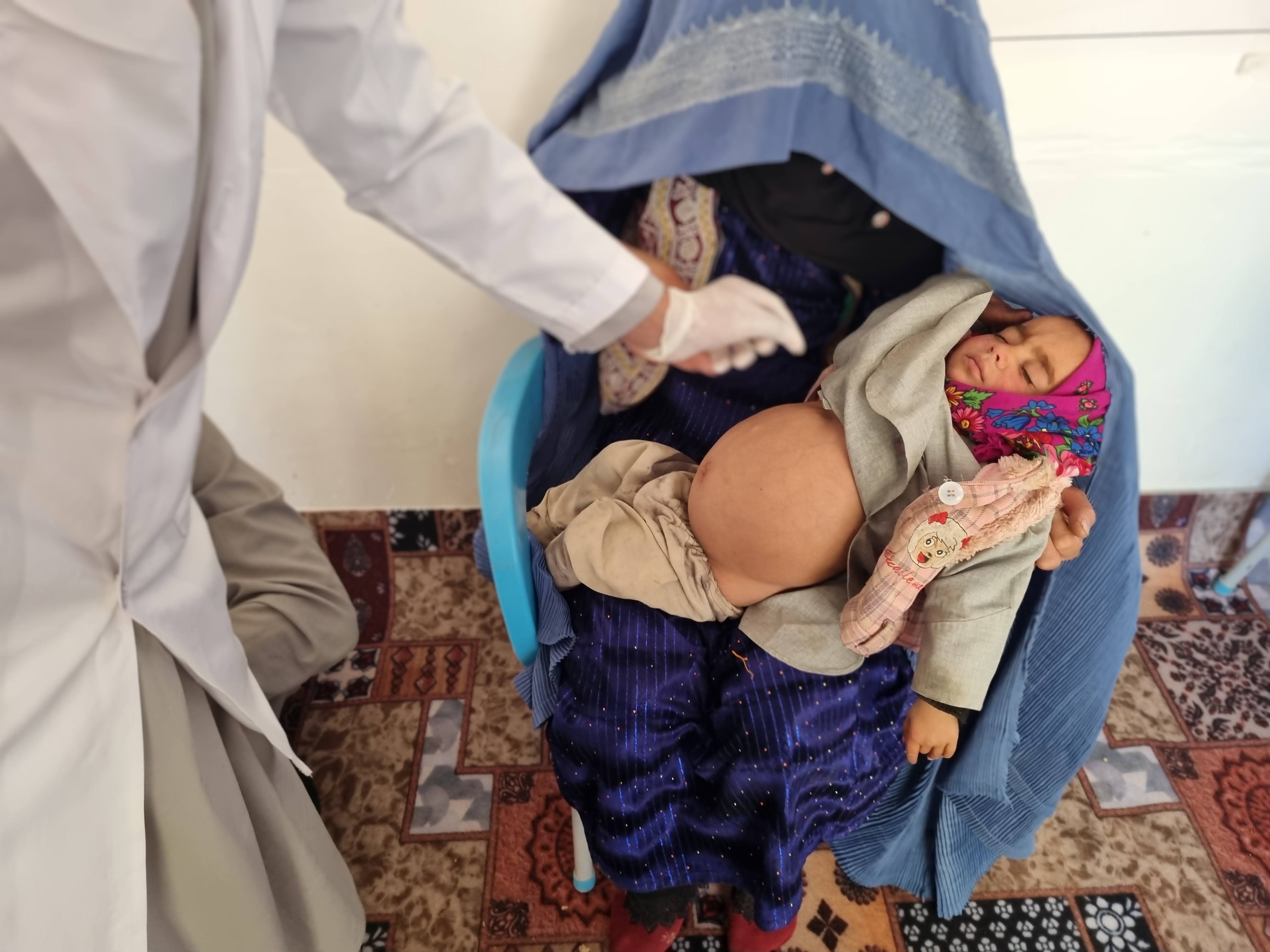 A young child cradled by his mother wearing a burka while a healthcare professional's arm is visible.