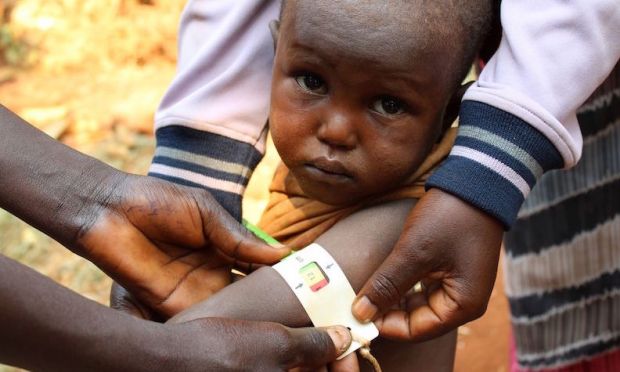 Government Of Germany Helps Fight Against Malnutrition In Burundian Children Government Of Germany Helps Fight Against Malnutrition In Burundian Children