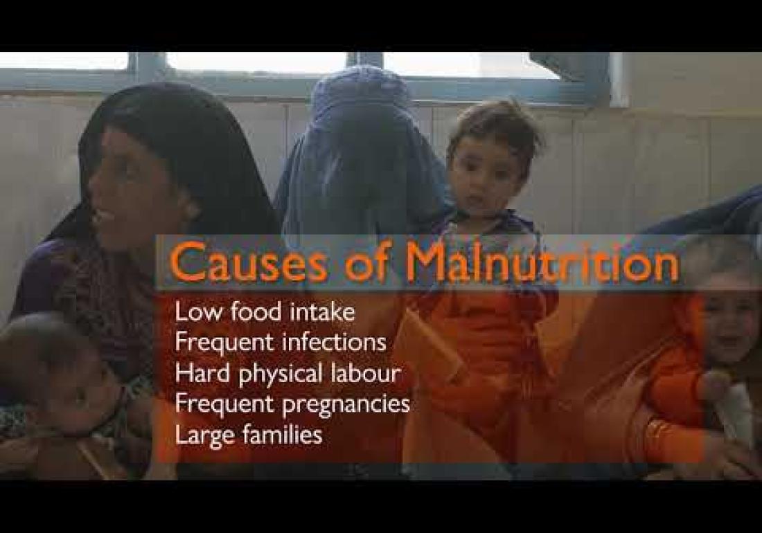 World Vision Afgthanistan - Fighting Malnutrition