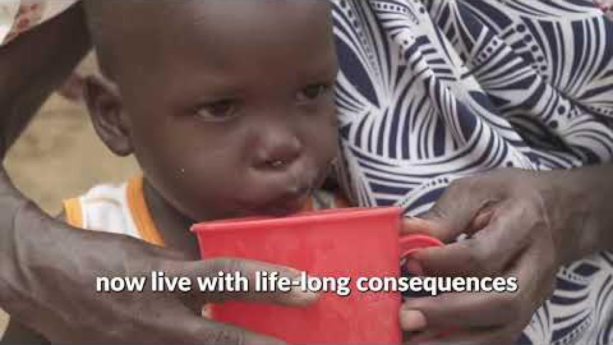 Hunger and malnutrition has affected hundreds of thousands of children in Sudan