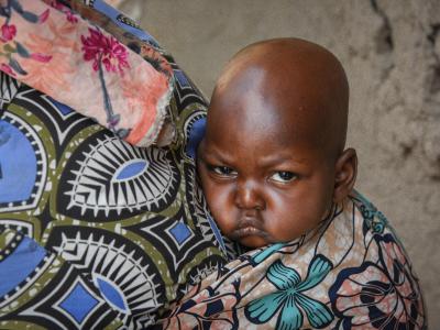 Gakuru, a 2-year-old child, was screened for malnutrition in Kiseguro, eastern Democratic Republic of Congo.