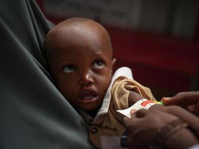 health facilities in Somalia are overwhelmed