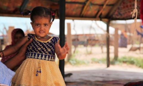 Toutou, at 2 years old, treated for severe acute malnutrition