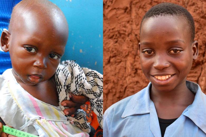 Swangirai in Zambia when he was 11 months old and aged 12 years.