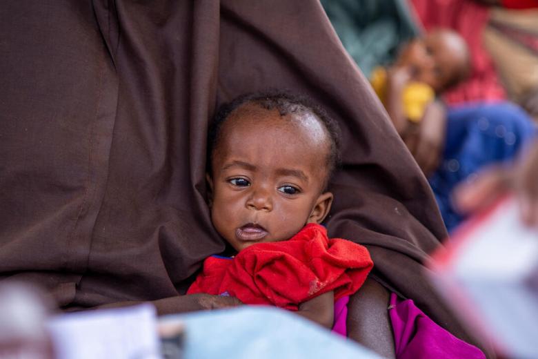 a small malnourished somali child