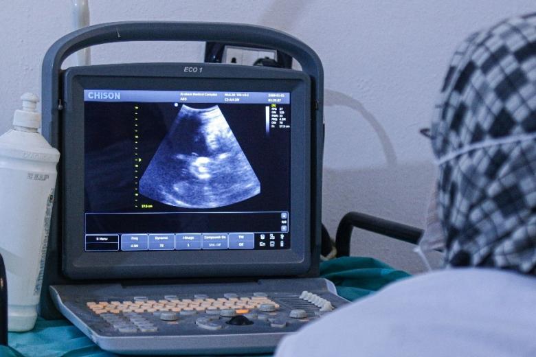 Azizeh’s baby appearing on the ultrasound machine while doing periodic visits to our partner’s centre.