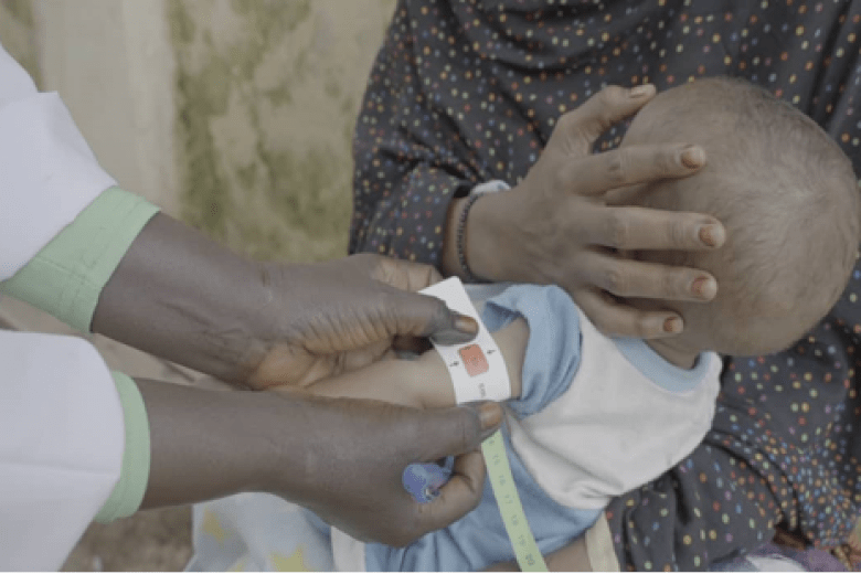 World Vision Sudan is using mobile clinics to provide free health and nutrition services to conflict-affected communities, especially children