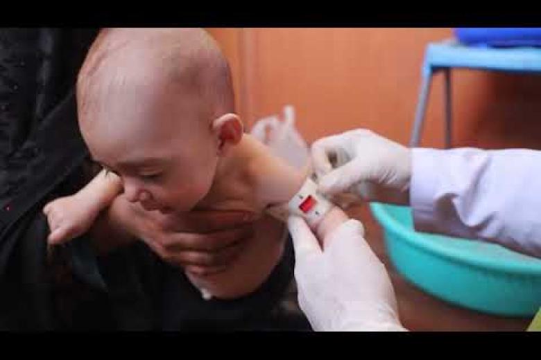 World Vision Afghanistan Complex Emergency Response 6 Months Sectoral Video-Health & Nutrition