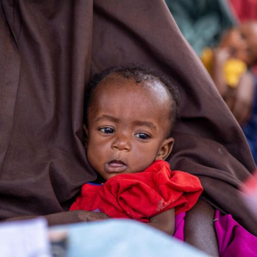 Eight-month-old Jaafar at a World Vision-supported nutrition centre in Baidoa, Somalia.