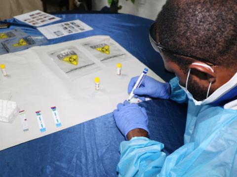 HIV test 