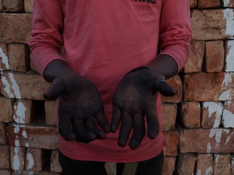 Hands of a child engaged in hazardous labour in Korea