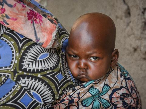 Gakuru, a 2-year-old child, was screened for malnutrition in Kiseguro, eastern Democratic Republic of Congo.