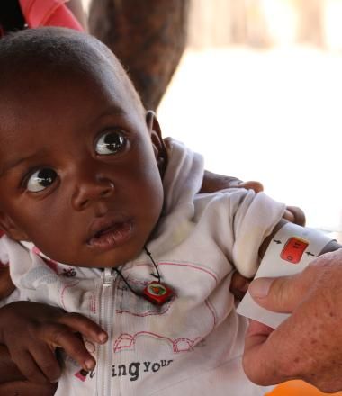 Beto, is tested and treated for malnutrition in Angola