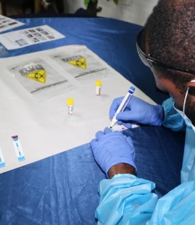 HIV test