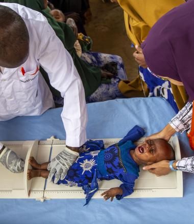 Hamdi Yarrow Mustaf, 7 months old was brought in to a World Vision nutrition clinic in Baidoa in South West State and upon screening found to be severely malnourished, weighing only 4 kilograms at the time. 