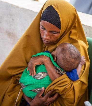Mother in Somalia cradles her malnourished child at World Vision feeding center
