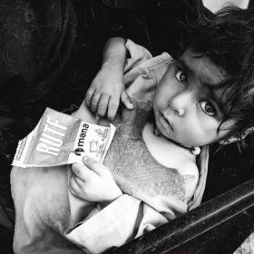 Child holding therapeutic food package